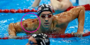 landscape-1470629095-michael-phelps-cupping