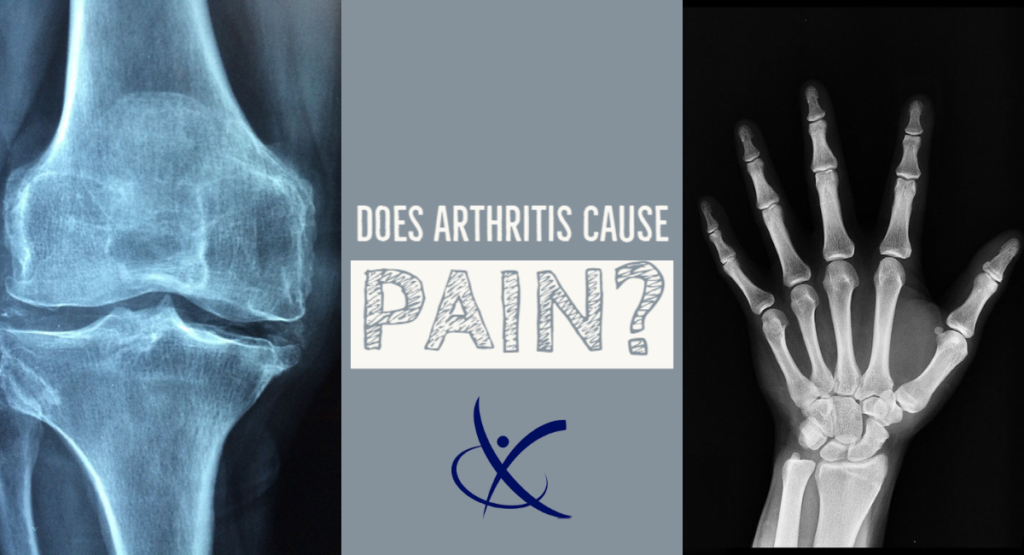 Why Your Arthritis May Not Be the Pain Culprit
